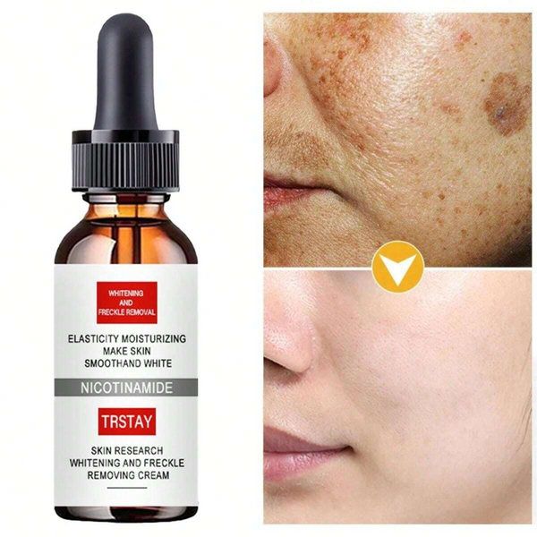 Last Day Of Discount 🔥 Radiant Skin Cream