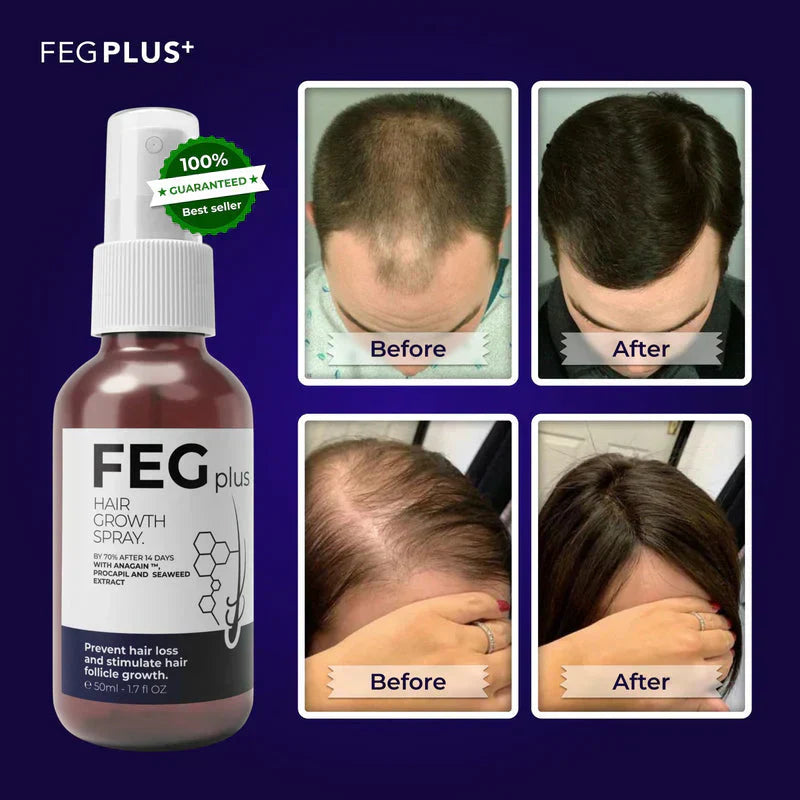 LAST DAY OF DISCOUNT 🔥 FEG HAIR GROWTH SPRAY