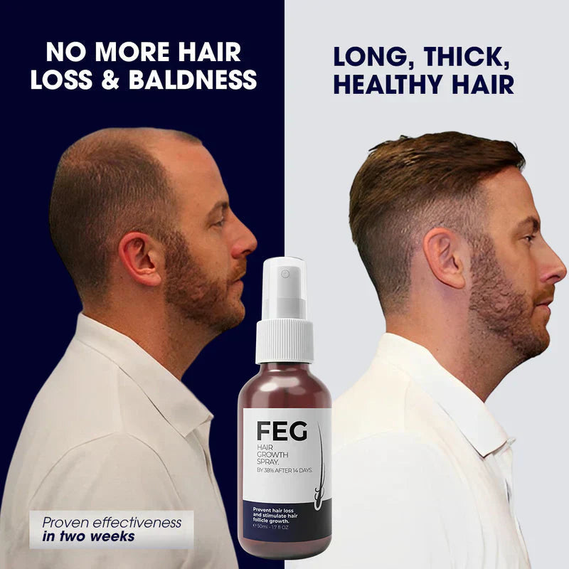 LAST DAY OF DISCOUNT 🔥 FEG HAIR GROWTH SPRAY