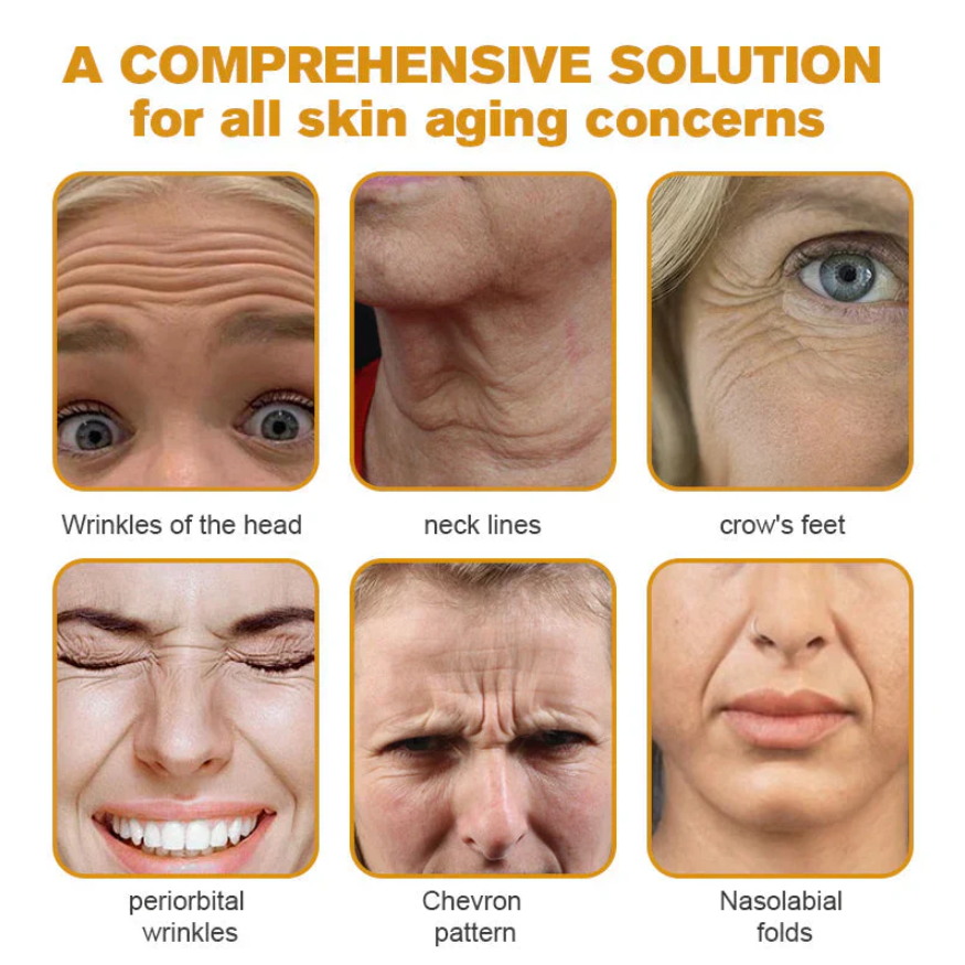 Last Day Of Discount 🔥 Bee Venom Wrinkle Removal Cream