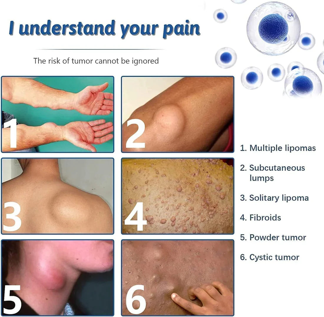 LAST DAY OF DISCOUNT  🔥  LIPOMA REMOVAL SPRAY