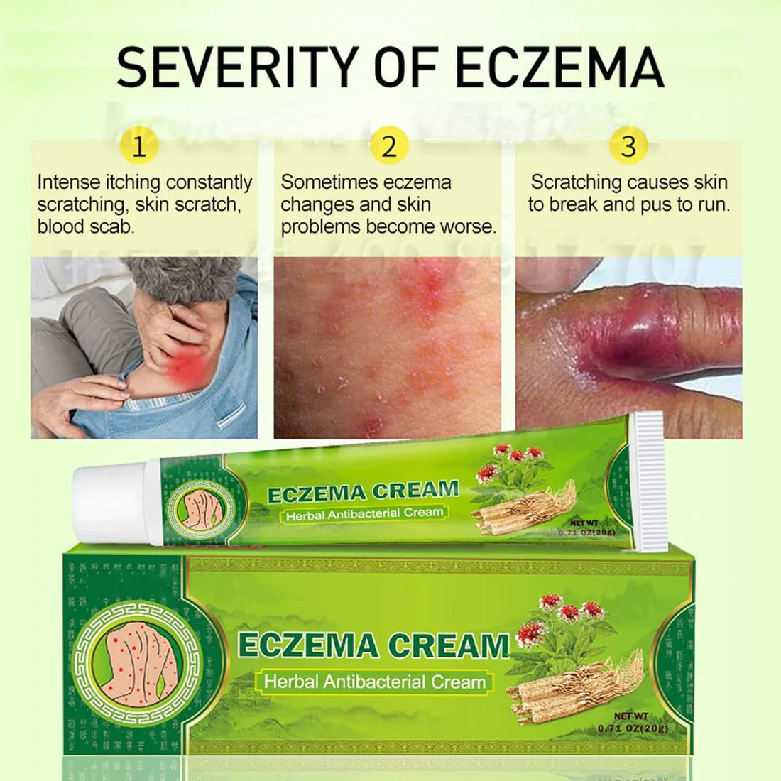 LAST DAY OF DISCOUNT 🔥 Psoriasis Cream (Original)