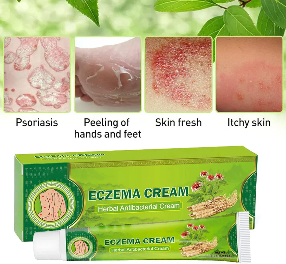 LAST DAY OF DISCOUNT 🔥 Psoriasis Cream (Original)